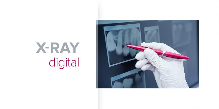 Dental digital x-ray