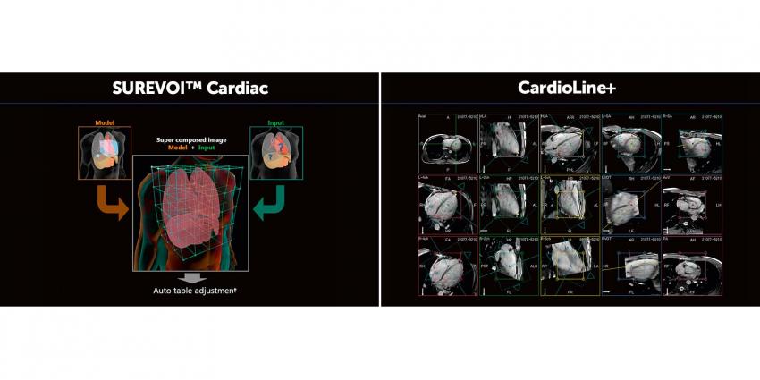 Интеллектуальная технология EasyTech-Fast — SUREVOI ™ Cardiac и CardioLine +