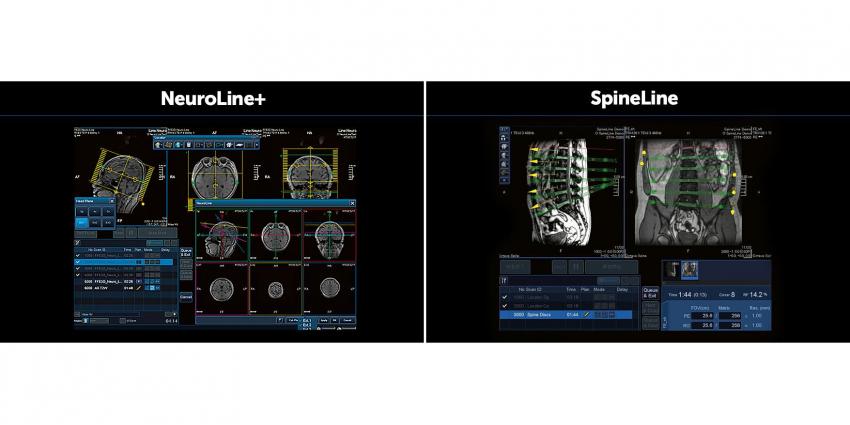 Интеллектуальная технология EasyTech-Fast — NeuroLine + и SpineLine
